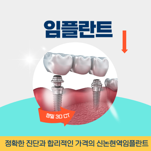 아산치과 아산시 치과 임플란트