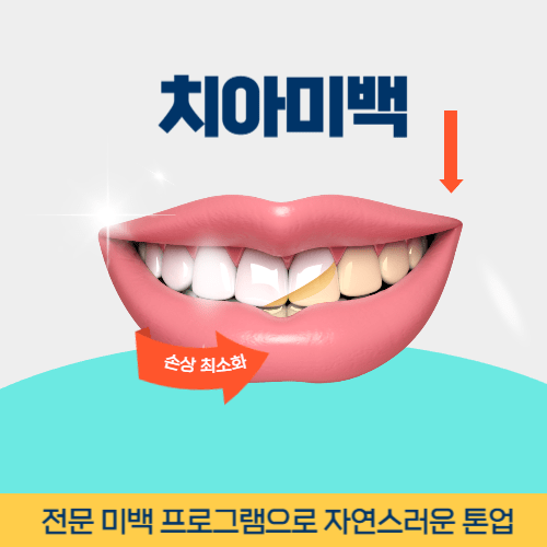 아산치과 아산시 치과 치아미백