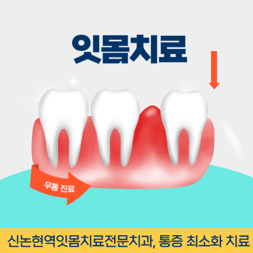 아산치과 아산시 치과 잇몸치료